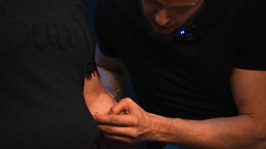 Zbliżenie na dłonie wykonujące zabieg akupunktury na przedramieniu uczestnika.